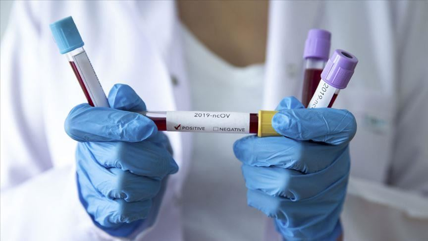 В Охе зафиксировано более 90 случаев заражения коронавирусом